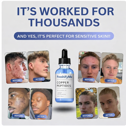 FreshifyMe GHK-CU Peptide