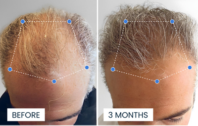 Advanced Copper Peptide Hair Growth Formula