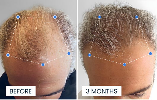 Advanced Copper Peptide Hair Growth Formula
