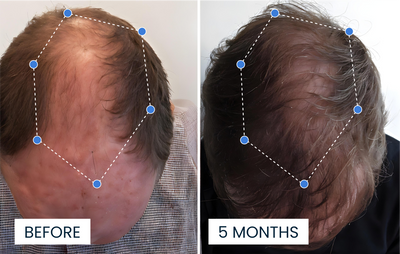 Advanced Copper Peptide Hair Growth Formula