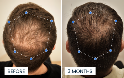 Advanced Copper Peptide Hair Growth Formula