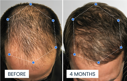 Advanced Copper Peptide Hair Growth Formula